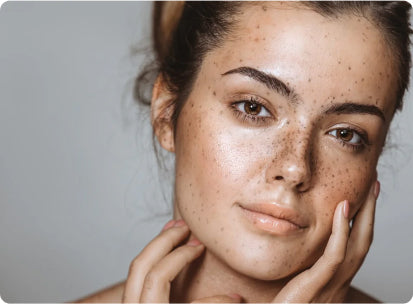 The Best Natural Remedies for Common Skin Conditions